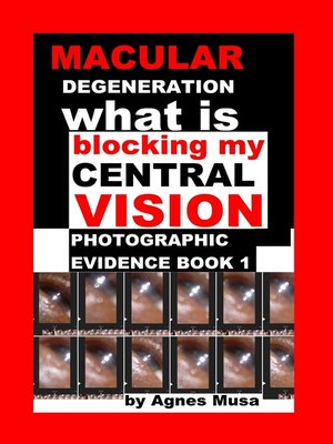 cover image of Macular Degeneration, What Is Blocking My Central Vision, Photographic Evidence Book 1